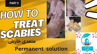 How to treat scabiespermanent solutionskin contagious infection ‎skinhealthvitality5959 [upl. by Eiffe]