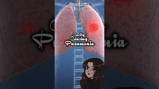 CavityCausing Pneumonia causativeorganisms shorts medicalshorts [upl. by Joane467]