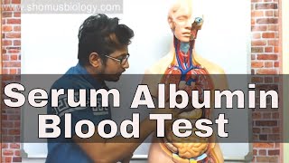 Serum albumin test in Hindi  Albumin blood test procedure [upl. by Casady]