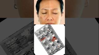 Limcee tablet to remove pigmentation dark spots acne scars dull skin viralshorts [upl. by Ecnedac]