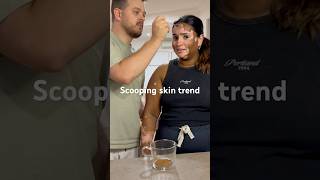 Latte 2 sugars x coffee latte skin vitiligo trend couple coffee lover funny funnyvideo [upl. by Khorma96]