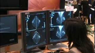 Hologic Unveils the Future of Breast Tomosynthesis [upl. by Granny834]