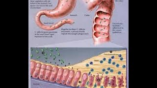 Clostridium Difficile [upl. by Bogoch684]