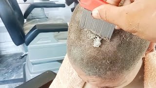 how to remove hair removal creamrepeat hair removal🥵 hair removal cream [upl. by Edecrem]