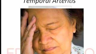 temporal arteritis [upl. by Adnovoj]