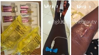 Glutathione Injection Whitening for black skin [upl. by Novhaj350]