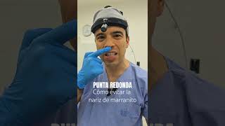 Cómo evitar la nariz de marranito cirugiadenariz rinoplastia nosejob [upl. by Bred176]