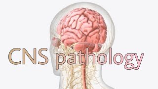 CNS pathology 3rd lecture [upl. by Any]