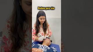 Microneedling dermatologist hisar [upl. by Lashonde613]