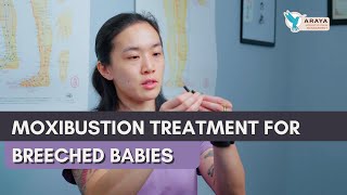 Moxibustion for Breeched Babies  with Dr Khanita [upl. by Laamak]