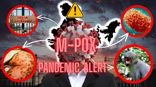 MPOX VIRUS another pandemic after corona virus news [upl. by Eelyah366]