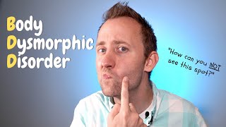 Body Dysmorphic Disorder BDD  What it looks like and the treatment [upl. by Meerek]