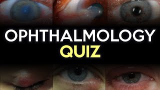 Ophthalmology Quiz [upl. by Benia30]