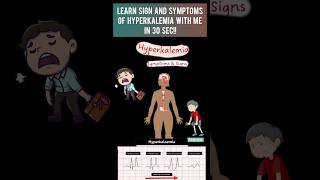 Hyperkalemia signs and symptomshyperkalemia mbbs medicaldegree [upl. by Atinehs673]