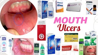 mouth ulcers Aphthous ulcers [upl. by Yatnoed319]