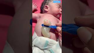 How Big Umbilical Cordmedical newbornbaby viralvideo [upl. by Frame]