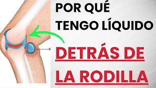 🦵 Por Qué Tenemos LÍQUIDO e INFLAMACIÓN Detrás De LA RODILLA y Cómo Solucionarlo [upl. by Kirst]