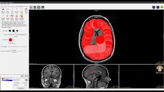 Analyze 150  Segment Freehand Draw 2D Region Definition [upl. by Liba]