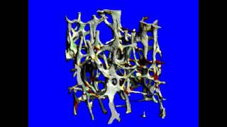 Finite Element Simulation on microCT of Cortical Bone [upl. by Aicyla]