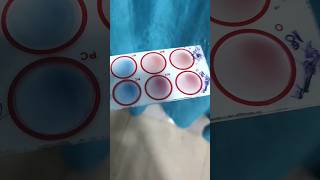 Agglutination test mixing procedure [upl. by Keyek]