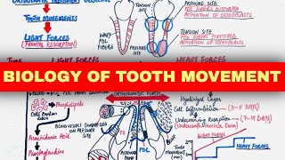 The Biology Of Tooth Movement Part 2  Orthodontics [upl. by Tami]