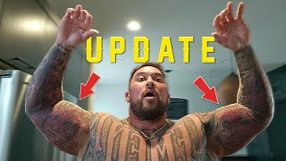 Arm Injury Update And Leg Day [upl. by Vinni]