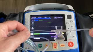 Capnography Overview Full VideoZOLL Tips and Tricks [upl. by Aikyt752]