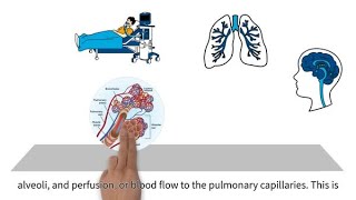 MedEd capnography byte 4 Ventilation perfusion mismatching [upl. by Adnohsat943]