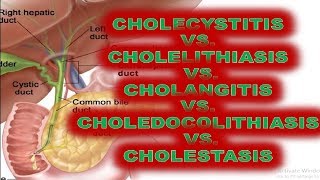 Perbedaan Cholelithiasis Cholecystitis Choledocolithiasis Cholangitis Definisi Patofisiologi Gejala [upl. by Scheer]