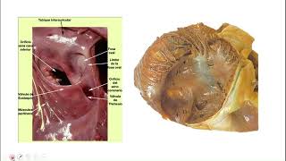 TALLER DE ANATOMÍA CORAZÓN CONFIGURACIÓN INTERNA [upl. by Greeley]