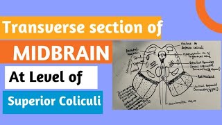 Midbrain transverse section at superior colliculus drurmila3614 [upl. by Nomyar]