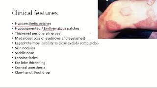 LeprosyHansens disease Pathogenesis Clinical features and treatment l USMLE [upl. by Nnuahs]