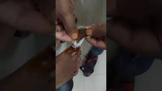 সার্জারী পরবর্তী সেলাই খোলা।। Stitch removal [upl. by Simah]