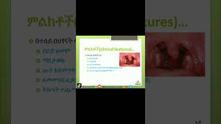 Tonsillitis Explained Symptoms Causes and Treatment Tonsillitis HealthTips የቶንሲልኢንፌክሽን [upl. by Lorelie]