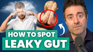 8 Signs Your Gut is LEAKY [upl. by Isa]