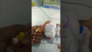 How to insert cannula in newborn baby ventilator newborncare criticalbaby [upl. by Horatius]