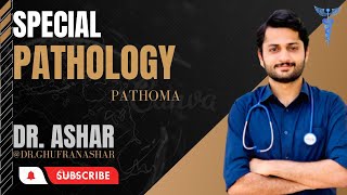 Gallbladder and Biliary tract PathologyPart1PathomaDr ASHAR [upl. by Aisats]