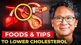 Dr William Lis SHOCKING Tips to Lower Cholesterol Foods You Need to Know [upl. by Huckaby]