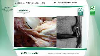 O Ligamento Anterolateral do joelho  Dr Camilo Partezani Helito [upl. by Willey]