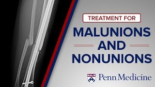 Emerging Techniques for Malunions and Nonunions  The Penn Orthoplastic Limb Salvage Center [upl. by Ellezaj]