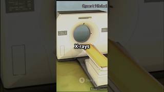 How CT Scans work shorts science medecin [upl. by Resiak246]