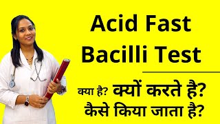 Acid Fast Bacilli Test Explained in Hindi  TB Test Kaise Hota Hai [upl. by Azilef321]