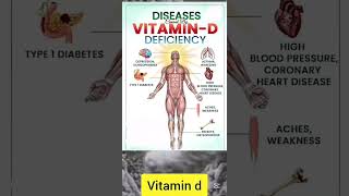 Diseases caused by deficiency of vitamin D [upl. by Eniowtna]