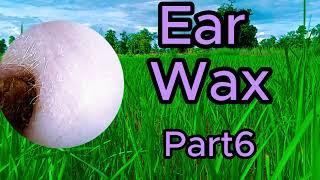 ear wax removal asmr [upl. by Silvers]