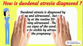 Duodenal atresia  My Wy Radiology [upl. by Marieann]