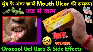 Oracool gel  Oracool gel kaise use kare  Oracool gel uses in hindi  Mouth ulcer treatment [upl. by Aynna175]