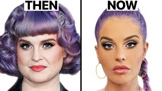 Kelly Osbourne Plastic Surgery  Surgeon Reacts [upl. by Narih]