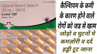 Celol D3 Plus Tablet Uses amp Dose  Calcium amp Vitamin D3  Healthy Bonnes Damage Nerve [upl. by Dorris]