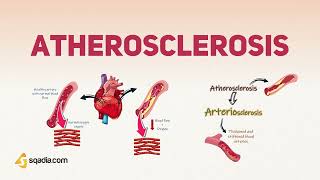 Atherosclerosis Physiology Pathophysiology and Pathogenesis [upl. by Annahsirhc]