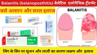 balanitis ka allopathic treatment in hindi लिंगपर लालदाने सफेददाग और खुजलीकी सबसे अच्छा ट्रीटमेंट [upl. by Enelrahs]